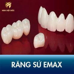 Bọc Răng Sứ Emax Có Tốt Không Tìm Hiểu Cùng Nha Khoa Chùa Láng