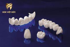 Tìm Hiểu Về Veneers Sứ Làm Đẹp Răng